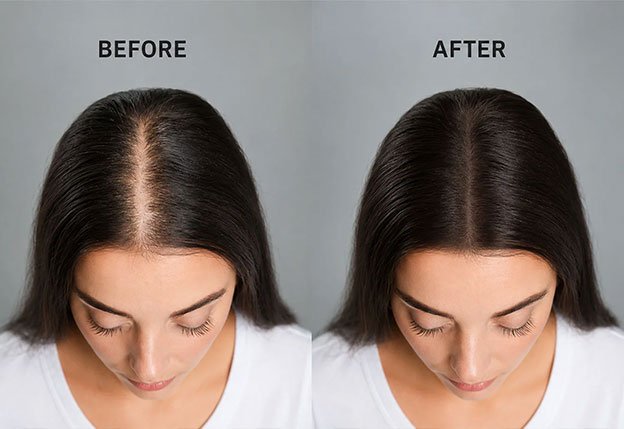 Age Spots, Moles & Skin Tags at AZ Esthetics