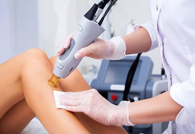 Age Spots, Moles & Skin Tags at AZ Esthetics