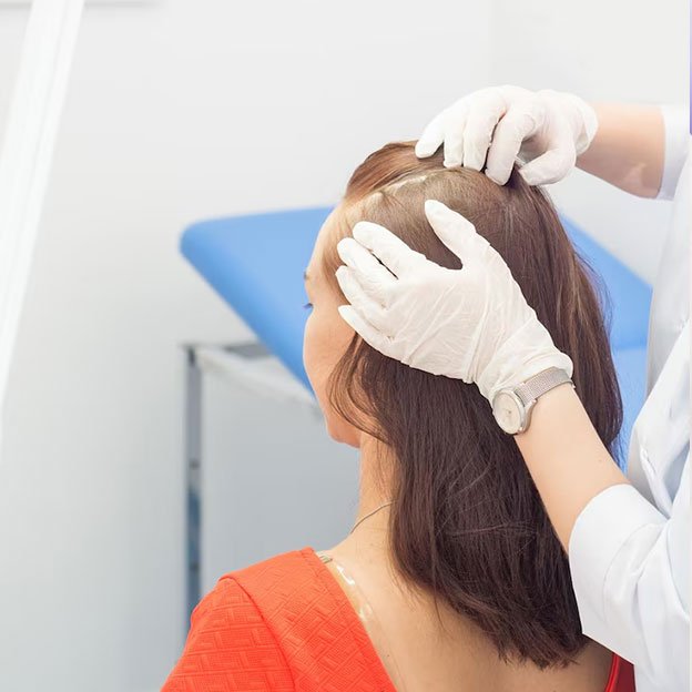 Scalp Pigmentation